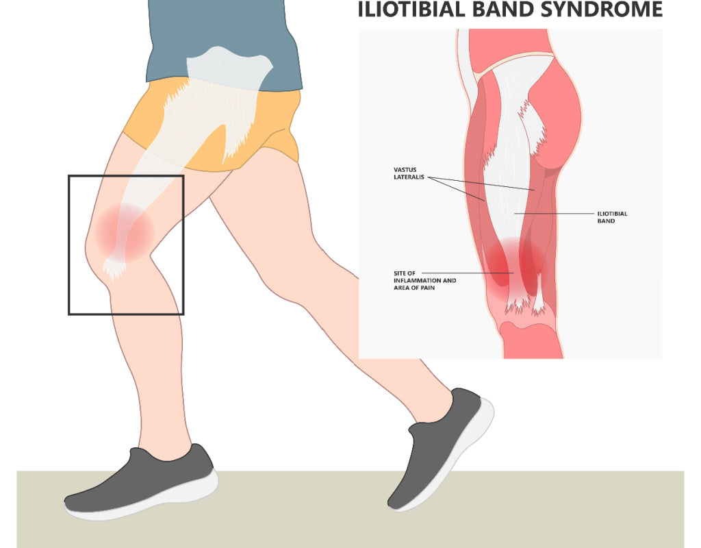 5 stretches to do before running to relieve pain from IT Band