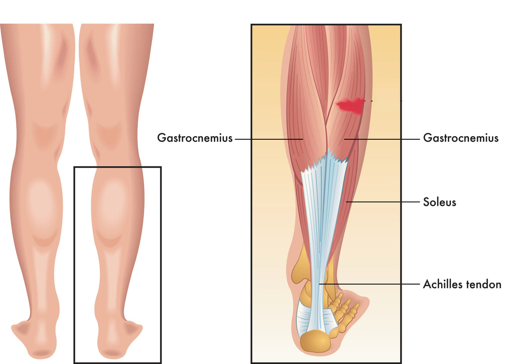 Medical illustration of the calf muscle
