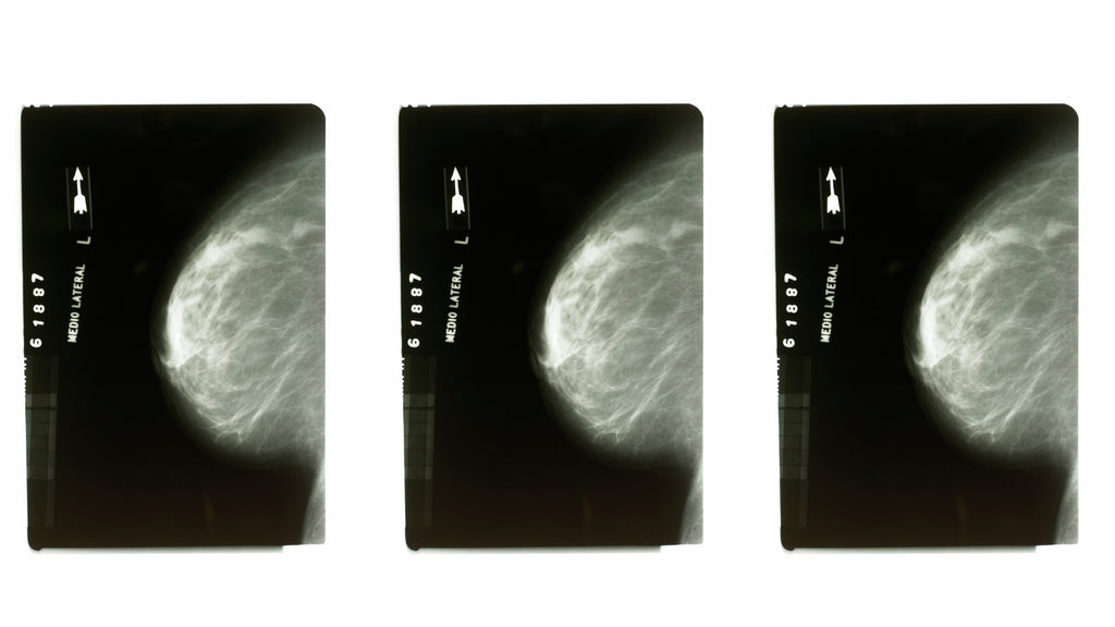 nood blog post 10 things to know about mammograms