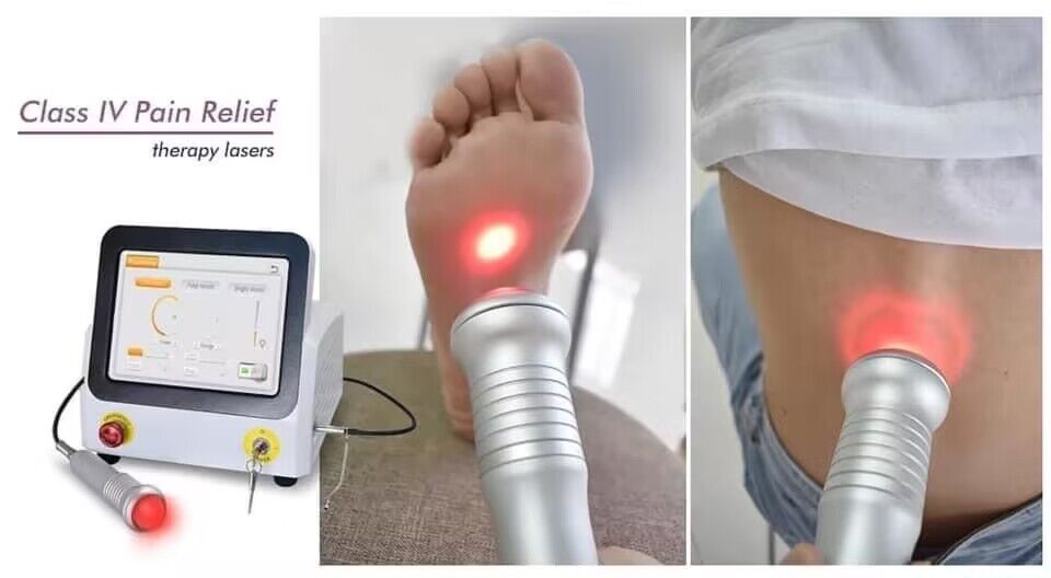 laser therapy for arthritis