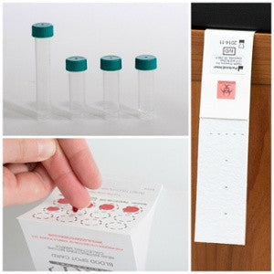 Cortisol Testing in Saliva, Blood & Urine