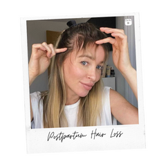 Lauren Pope's Postpartum hairloss journey