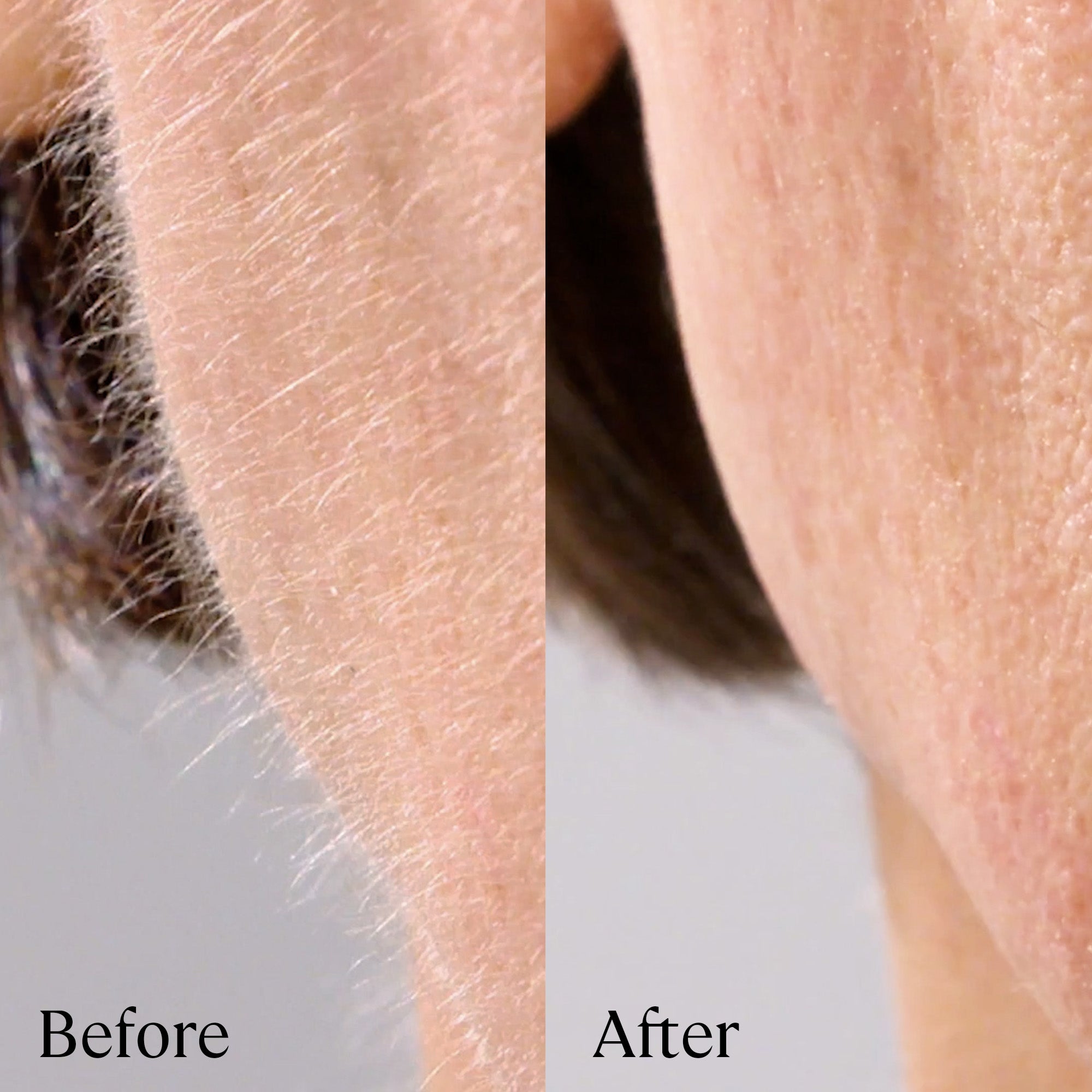 Close-up comparison of skin before and after hair removal.