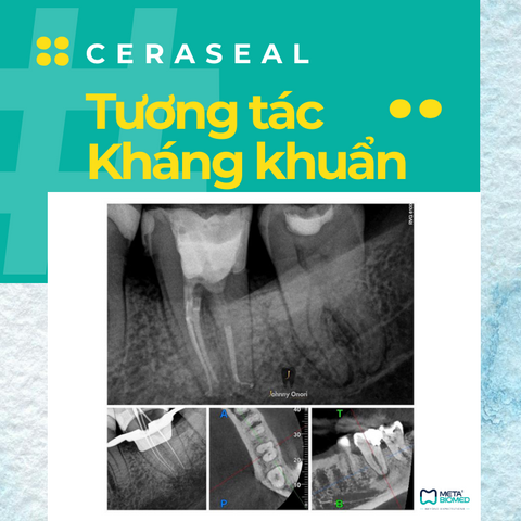 Ceraseal - Cement trám bít sinh học - tương tác kháng khuẩn