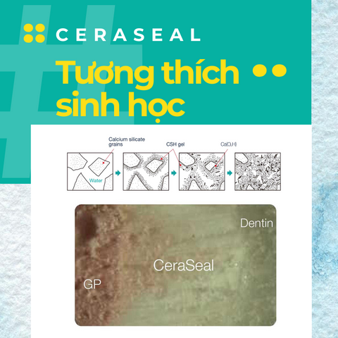 Ceraseal - Cement trám bít sinh học - tương thức sinh học