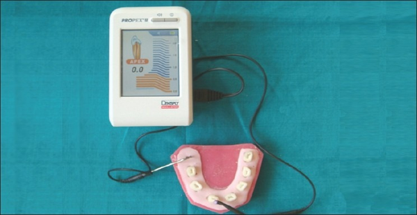Chỉ định sử dụng Máy định vị chóp răng Propex II Dentsply Sirona - 49P