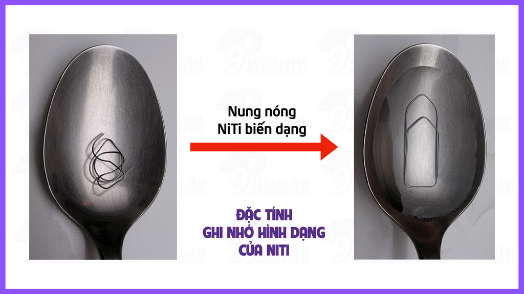 Tính ghi nhớ hình dạng của NiTi - 49P I&M Recommend