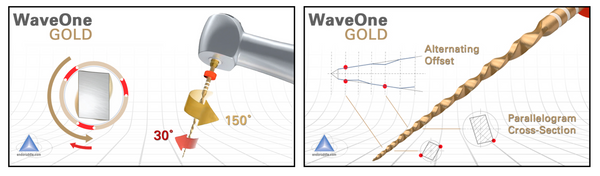 Thiết kế trâm xoay lắc NiTi xử lý nhiệt Waveone Gold Dentsply Sirona - 49P