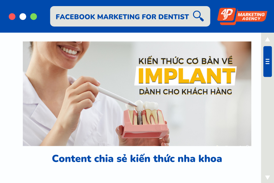 Content chia sẻ kiến thức nha khoa cho khách hàng - 49P