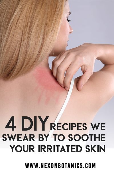 4 DIY Recipes We Swear By to Soothe Your Irritated Skin pin