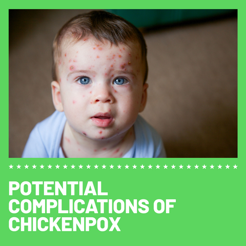 What are the Potential Complications of Chickenpox? 