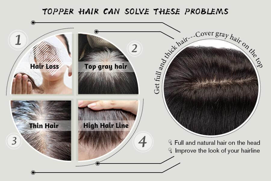 what is advantage of hair toppper