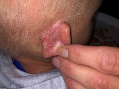 crusty eczema behind ears