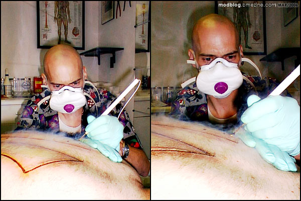 Steve Haworth Electrocautery at Infinite Body Piercing