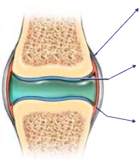 Damaged Knee Joint