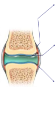 Damaged Knee Joint