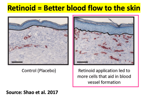 Retinoids improve blood flow