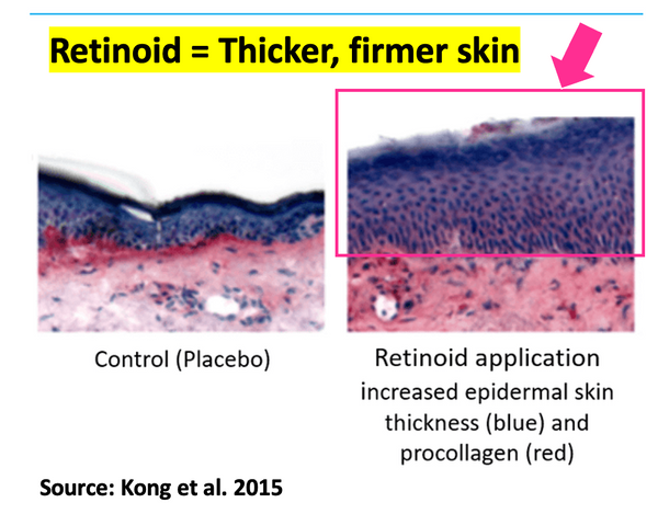 retinoids lead to firmer skin