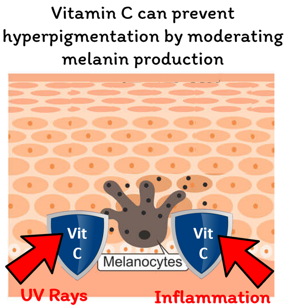 VC can moderate hyperpigmentation