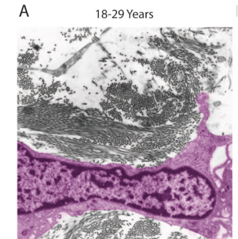 collagen and fibroblast in young skin