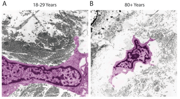 collagen fibroblast young old