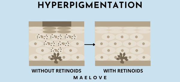 how hyperpigmentation happens