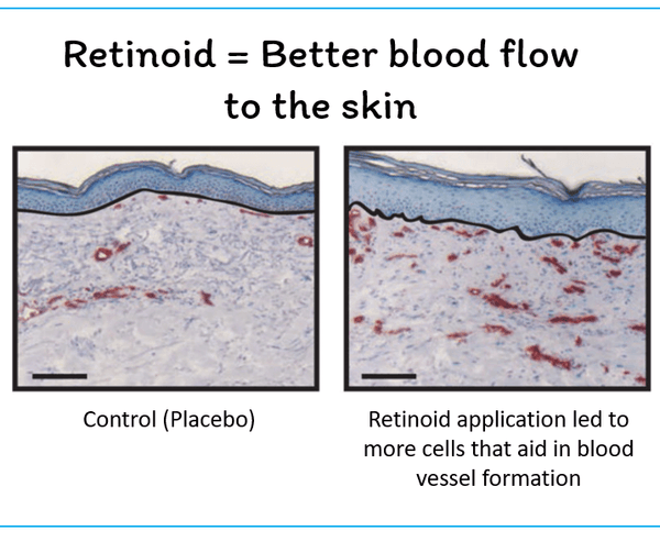 retinoids promote better blood flow to the skin
