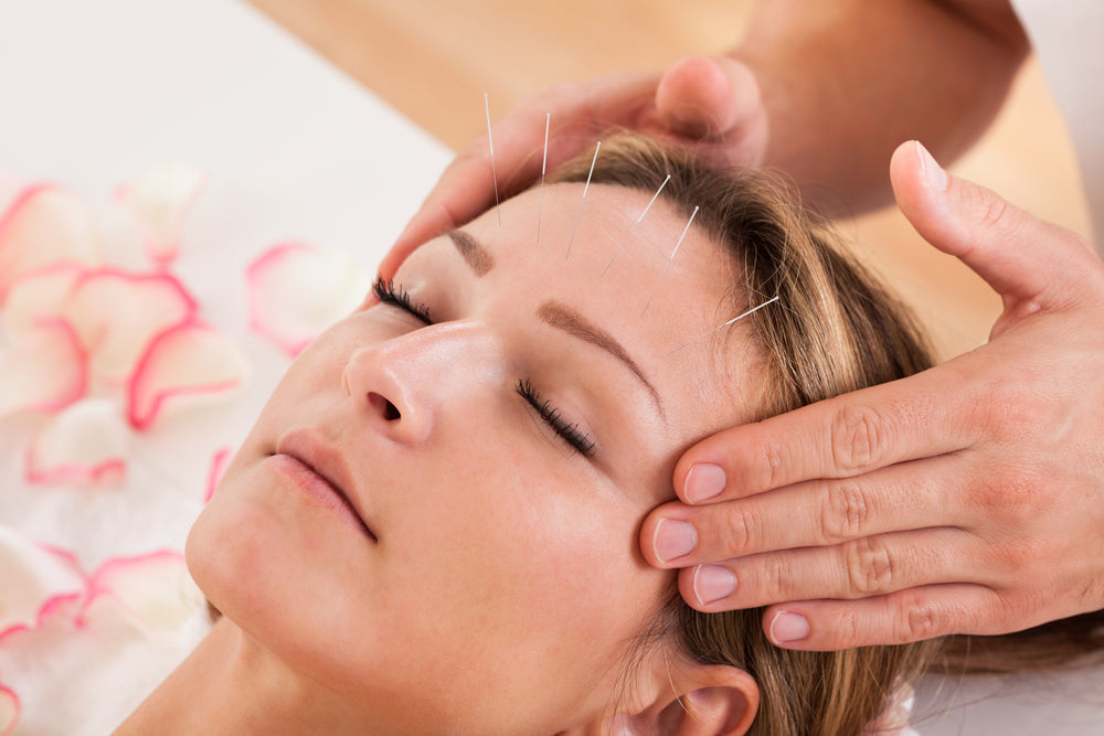 Best Benefits of Acupuncture
