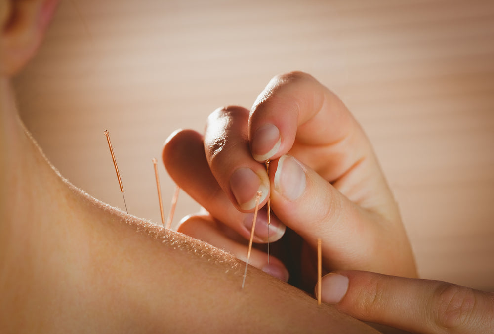 Best Benefits of Acupuncture