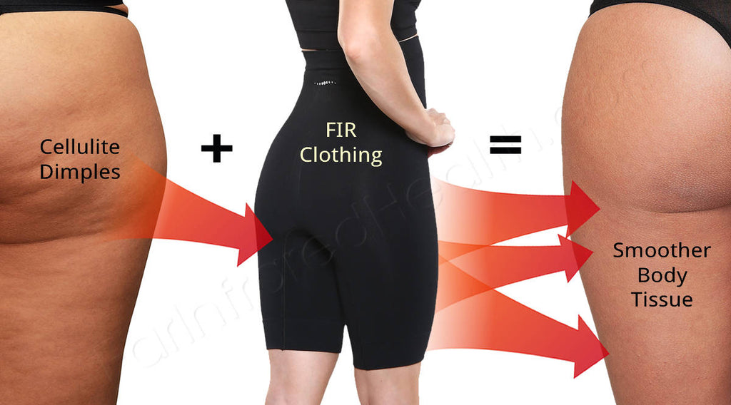 Cellulite Reducing  Infrared Energy Shapewear Smooths Cheesy Skin –