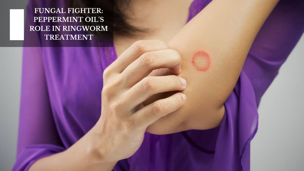 FUNGAL FIGHTER: PEPPERMINT OIL'S ROLE IN RINGWORM TREATMENT