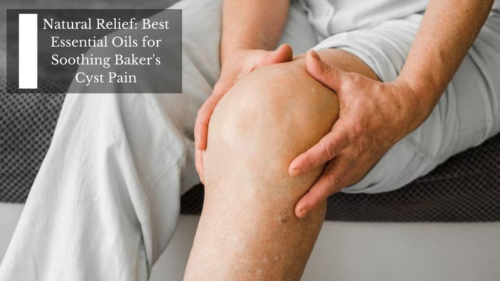 Natural Relief: Best Essential Oils for Soothing Baker's Cyst Pain