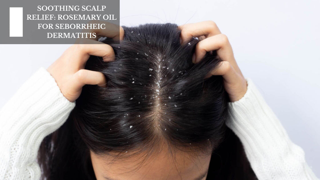 SOOTHING SCALP RELIEF: ROSEMARY OIL FOR SEBORRHEIC DERMATITIS