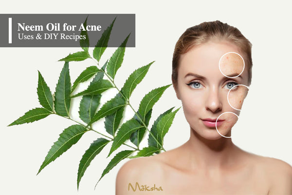 Neem Oil for Acne I Benefits & DIY recipes – Moksha Essentials Inc.