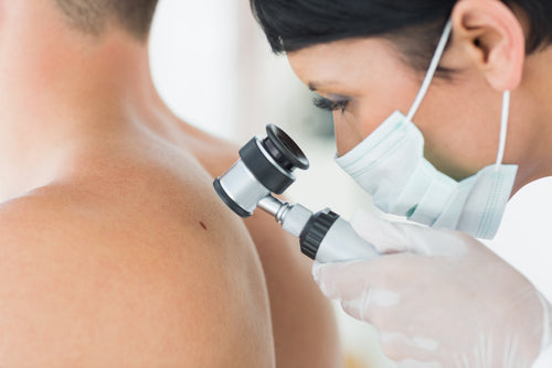 dermatologist examining mole