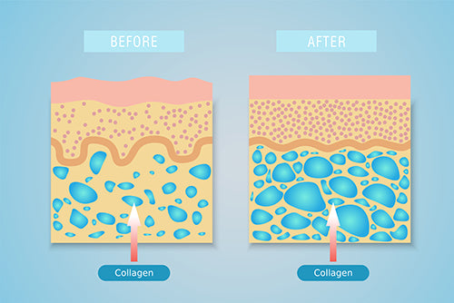 collagen before and after graphic