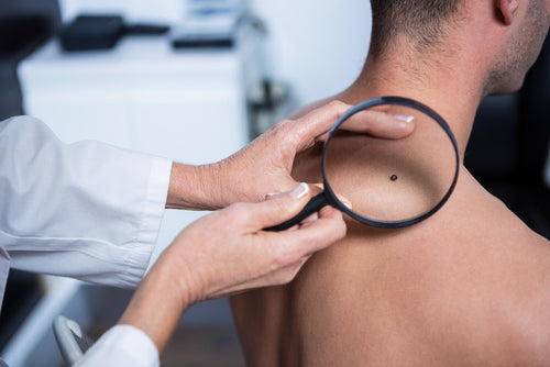 dermatologist examining mole