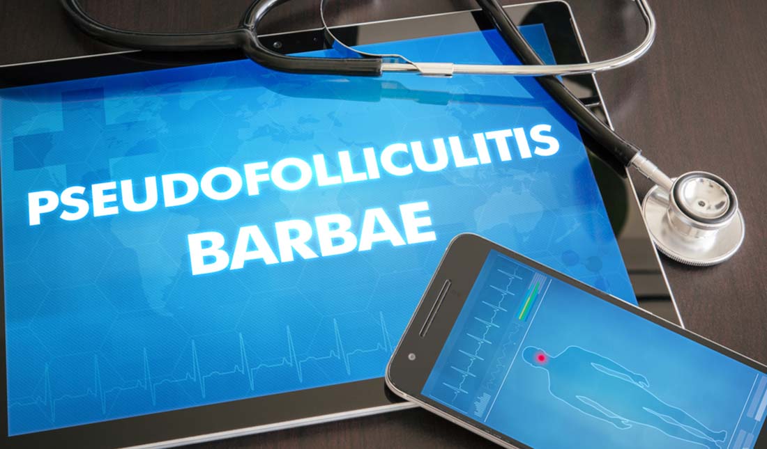 pseudofolliculitis barbae wording on smart devices