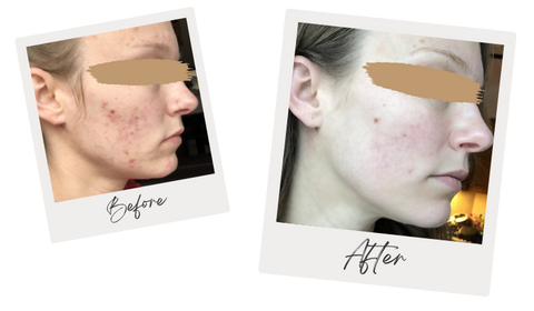 Mostly Natural Skincare for Sensitive Skin