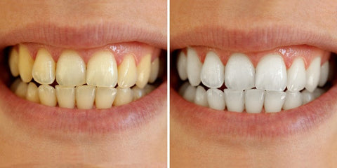 Aktivt kul til tandblegning med Sanzi Beauty charcoal teeth