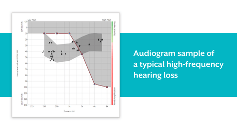 What is High-Frequency Hearing Loss