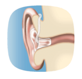 BTE Hearing Aid 