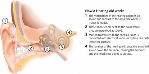 How do Hearing Aids Work