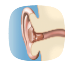 ITC Hearing Aids