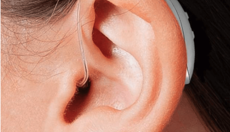 Hearing Loss