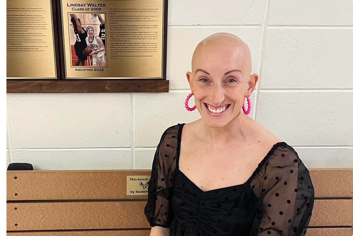 alopecia made lindsay walter empathetic and strong canada