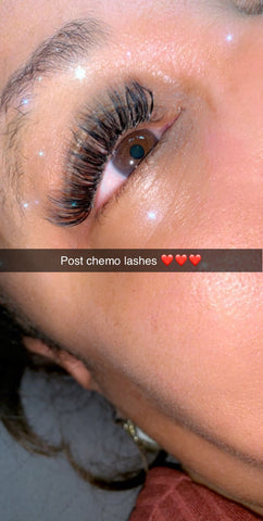 Post Chemo Lashes After