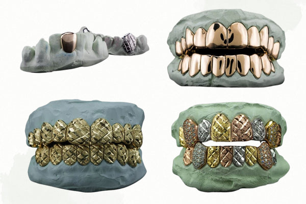 custom grillz