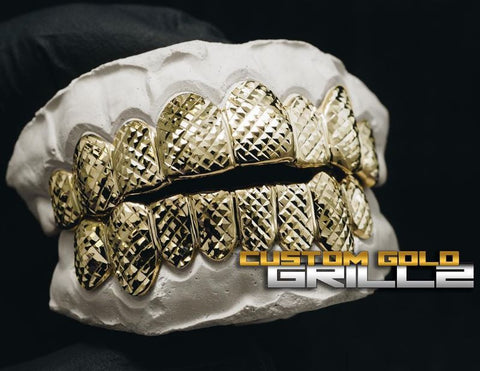 Custom-made or pre-made gold grillz - Which is the best?