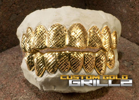 Factors Influencing Production Time of Custom Gold Grillz